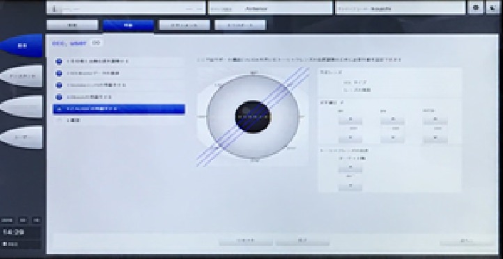 白内障手術を受けるために必要な確認事項、判断基準