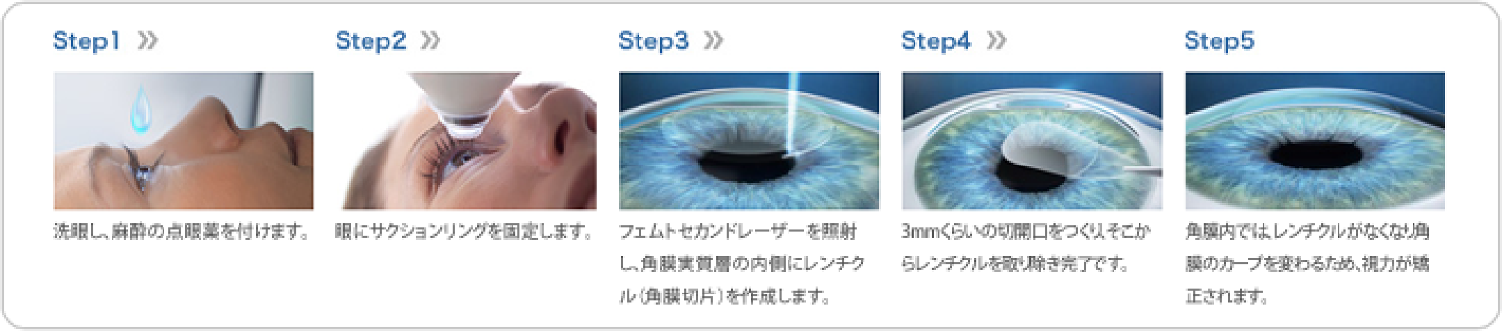 ReLEx（リレックス）